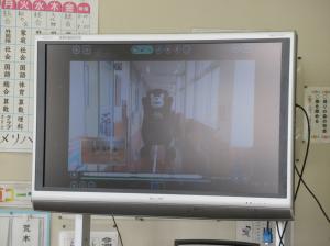 R7　フッ化物洗口４