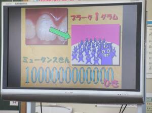 R7　５年歯みがき教室３